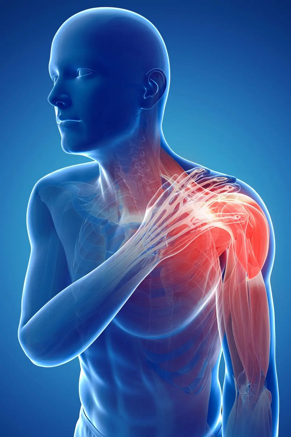 Shoulder Pain