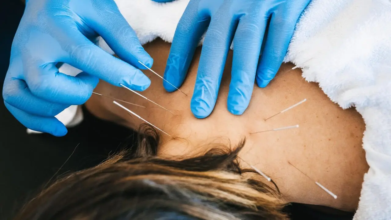 Dry Needling